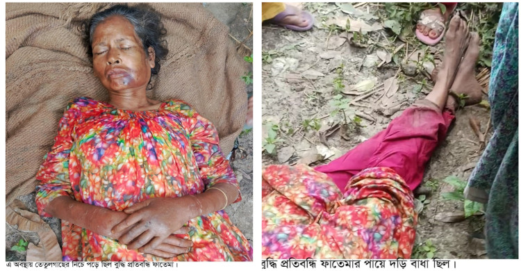 হাত-পা বেঁধে বুদ্ধি প্রতিবন্ধি সৎ মাকে নির্যাতন, ফেলে গেছে তেতুলগাছ তলায়