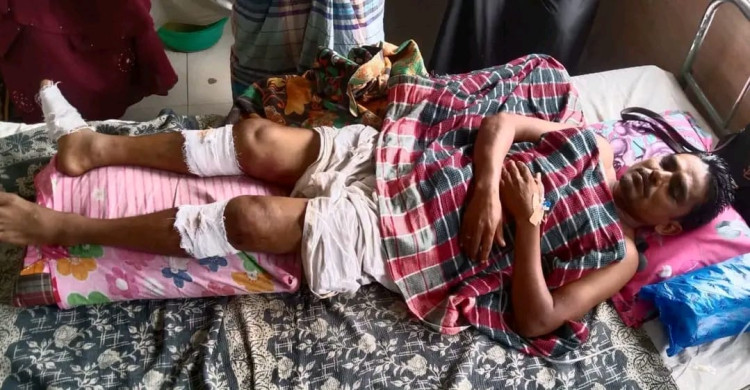 মাগুরায় স্বেচ্ছাসেবক দল নেতাকে পিঁটিয়ে হাসপাতালে পাঠাল দুর্বৃত্তরা
